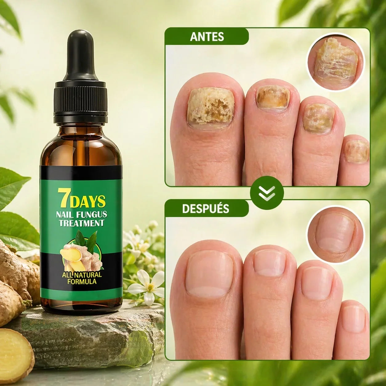 Aceite Quita Hongos 7 Días | Alivia hongos, mal olor y picazón desde l ...